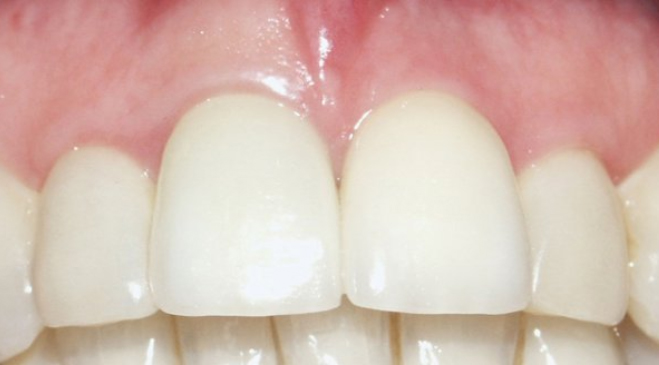 Image for Instant Dental Care with ID of: 1003474