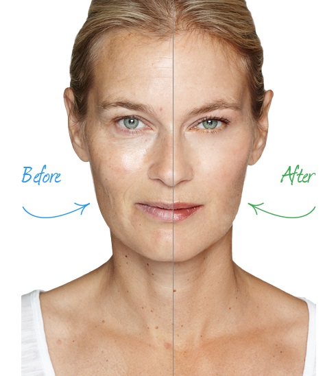 Image for Dermaactive Cream with ID of: 1014041