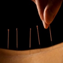 Image for Premier Acupuncture Clinic with ID of: 1017727