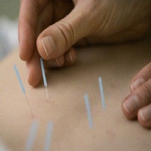 Image for Premier Acupuncture Clinic with ID of: 1017729