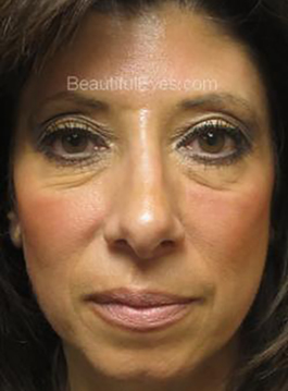 Image for Jeffrey Schiller MD with ID of: 1045057