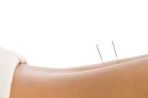Image for Total Wellness Acupuncture with ID of: 1047868