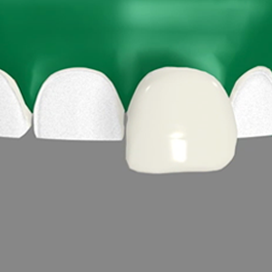 Image for Smile select Dental Office - Alta Loma, CA with ID of: 1054397