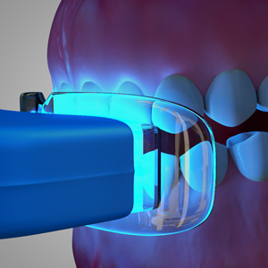 Image for Smile select Dental Office - Alta Loma, CA with ID of: 1054405