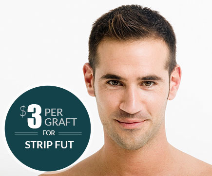 Image for Robotic Hair Transplants Boca Raton with ID of: 1054447