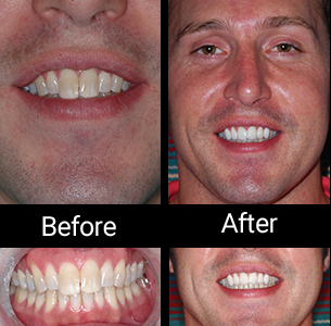 Image for Gary Ellenbogen, D.D.S. with ID of: 1111622
