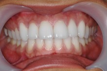 Image for Gary Ellenbogen, D.D.S. with ID of: 1111624