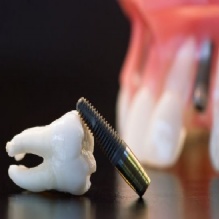 Image for SQV Dental Laboratory with ID of: 1113085