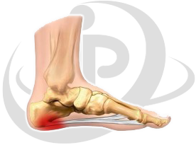 Image for Pursuit Physical Therapy with ID of: 1115547