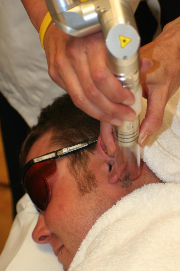 Image for TATTOO'SS Removal In Dubai with ID of: 1123174