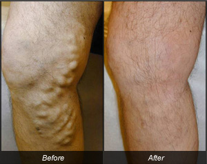 Image for Vein Doctor with ID of: 1168349