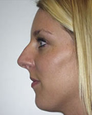 Image for The Seattle Rhinoplasty Center with ID of: 1182156