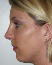 Image for The Seattle Rhinoplasty Center with ID of: 1182168