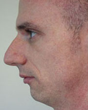 Image for The Seattle Rhinoplasty Center with ID of: 1182169