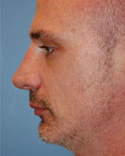 Image for The Seattle Rhinoplasty Center with ID of: 1182170
