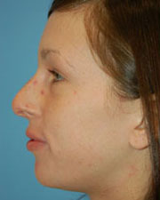 Image for The Seattle Rhinoplasty Center with ID of: 1182173