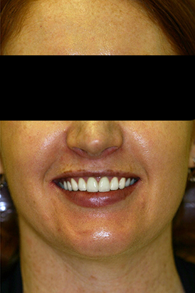 Image for Elegant Smile Dental with ID of: 1185984