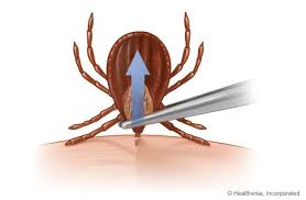 Image for Ticks Pest Control with ID of: 1192443