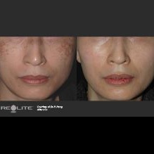 Image for Rejuvenations with ID of: 1194157