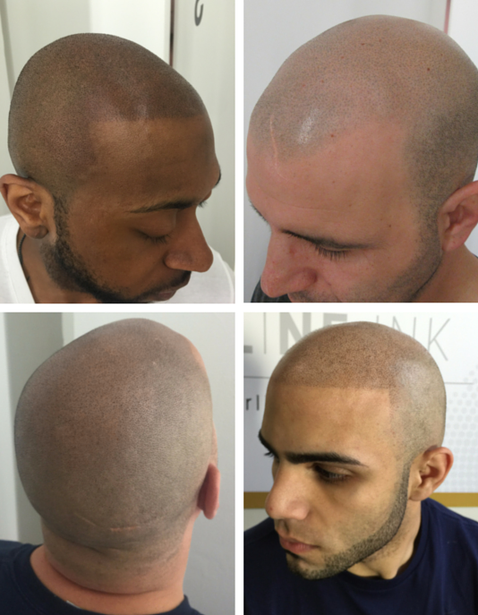 Image for Hairline Ink with ID of: 1197604
