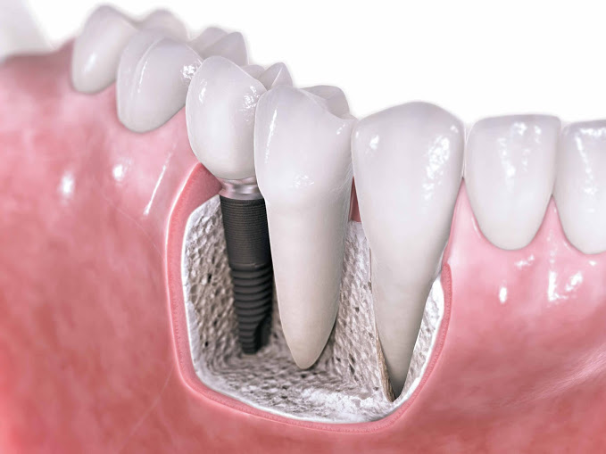 Image for Sachs Family Dental with ID of: 1201052
