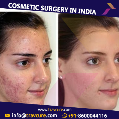 Image for Transform Your Appearance With Cosmetic Surgery with ID of: 1209308