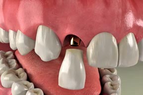 Image for Bischoff Family Dentistry with ID of: 1216385