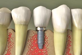 Image for Bischoff Family Dentistry with ID of: 1216393
