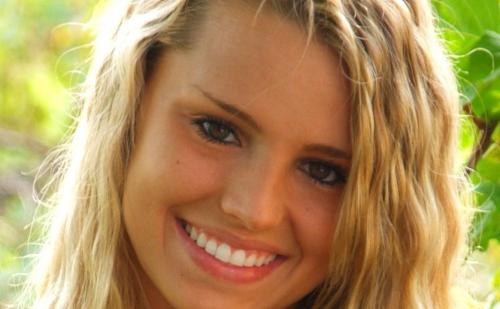 Image for Burbey Orthodontics with ID of: 1220316