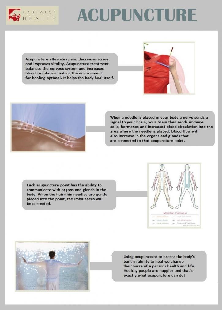 Image for What is Acupuncture? with ID of: 1224782