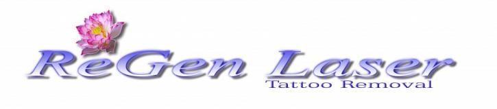Image for ReGen Laser with ID of: 1225696