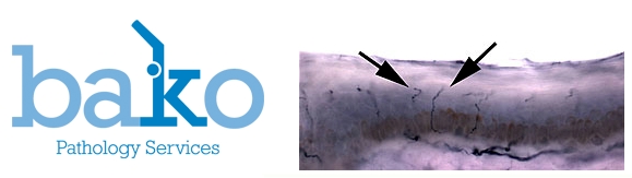 Image for Bako Pathology Services - Podiatric Pathology - ENFD Transport Kit [video] with ID of: 123122