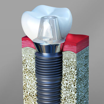 Image for uppal dental care with ID of: 1236216