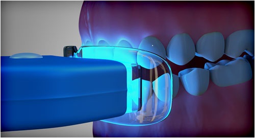 Image for uppal dental care with ID of: 1236219