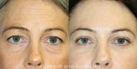 Image for Carmel Valley Facial Plastic Surgery with ID of: 1237466