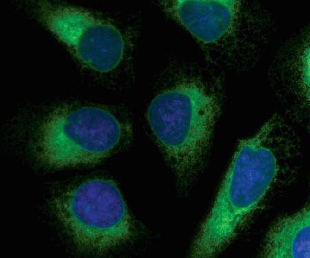 Image for Live Cell Imaging Market Projections And Current Trends with ID of: 1237951
