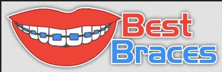 Image for Best Ceramic Braces with ID of: 1253128