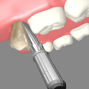 Image for Andrew R. Rahn DDS, PC with ID of: 1254330