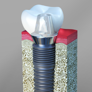 Image for Andrew R. Rahn DDS, PC with ID of: 1254339