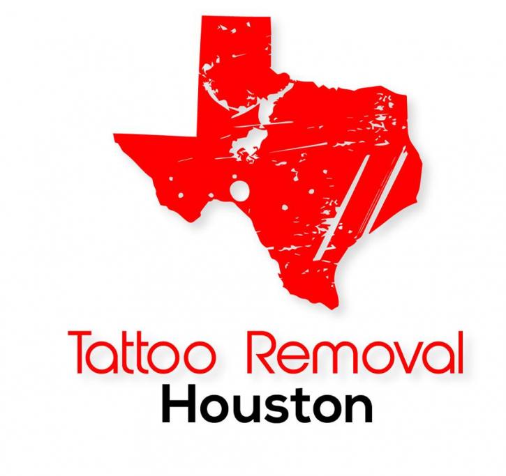 Image for Tattoo Removal Houston with ID of: 1275245