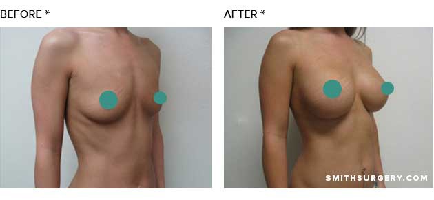 Image for Smith Plastic Surgery with ID of: 1276708