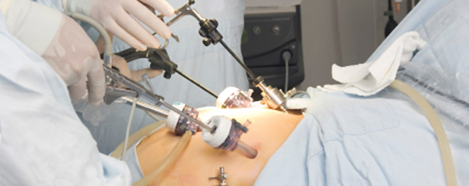 Image for Global Laparoscopy Devices Market 2014 – 2020 with ID of: 1277912