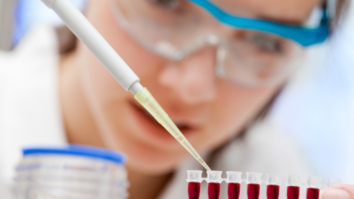 Image for Noninvasive Prenatal Testing Market Industry Perspective, Comprehensive Analysis and Forecast, 2014 – 2020 with ID of: 1297000