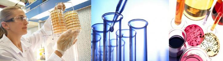 Image for Global Bacterial Disease Diagnostics Market Segment Forecasts up to 2021, Research Reports- SyndicateMarketResearch with ID of: 1321797