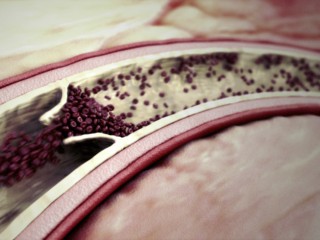 Image for Infuse Medical with ID of: 1334747
