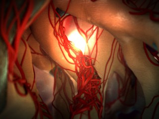 Image for Infuse Medical with ID of: 1334748