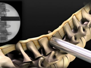 Image for Infuse Medical with ID of: 1334752