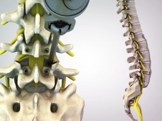 Image for Infuse Medical with ID of: 1334753