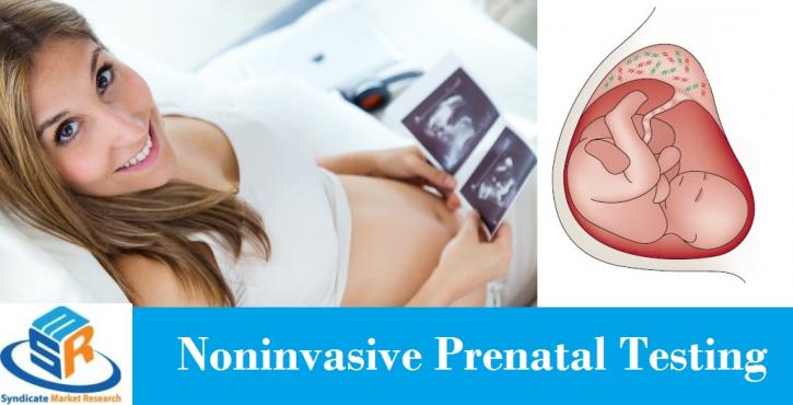 Image for Noninvasive Prenatal Testing MarketDynamics, Forecast, Analysis and Supply Demand 2014-2020 with ID of: 1336235