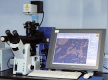 Image for SMR: Global Laser Capture Microdissection Market share, Trends and value 2020 with ID of: 1337995